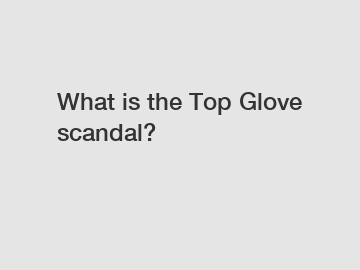 What is the Top Glove scandal?